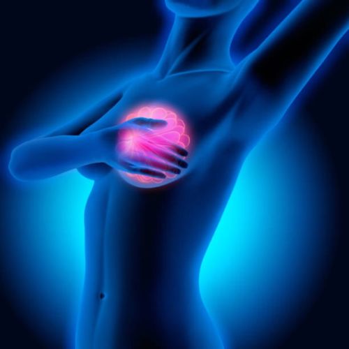 Carcinoma mammario: scoperto il gene che ne indica la predisposizione