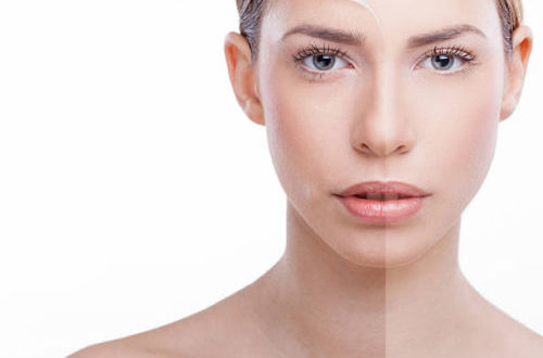 Peeling viso: il trattamento per una pelle luminosa e levigata
