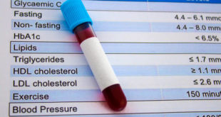 Colesterolo “cattivo”: uno dei principali fattori correlati al rischio di ictus 