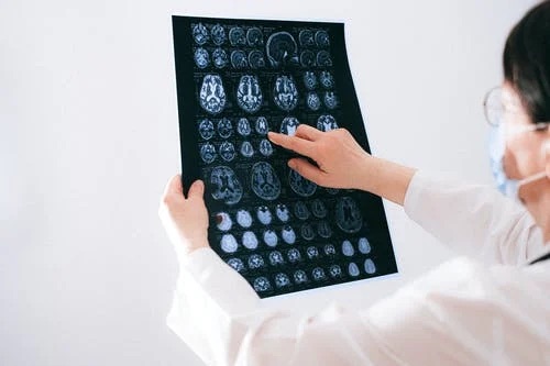 Patologie neurologiche: non solo malattie per “vecchi”