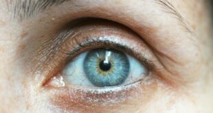 Occhio secco: donne in gravidanza o in menopausa tra le più colpite