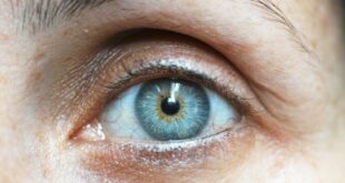 Le secrezioni oculari e salute visiva