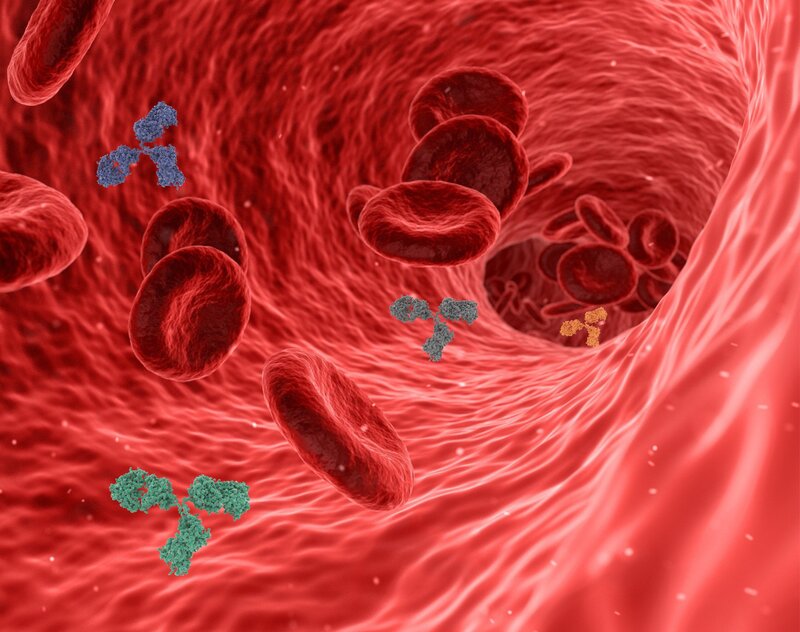 Aneurisma addominale: sintomi, cause, diagnosi e cure